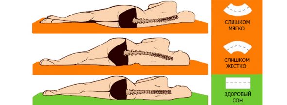 Effet orthopédique