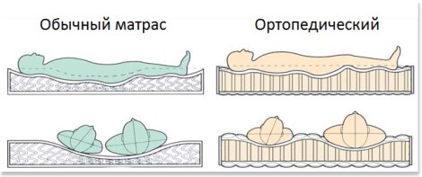 La différence de matelas