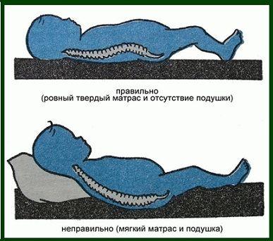 Mauvais et correct matelas